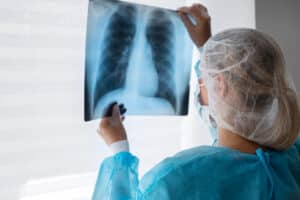 Desvendando o Terror: A Patologia Pulmonar que Ameaça sua Luta contra o Câncer!