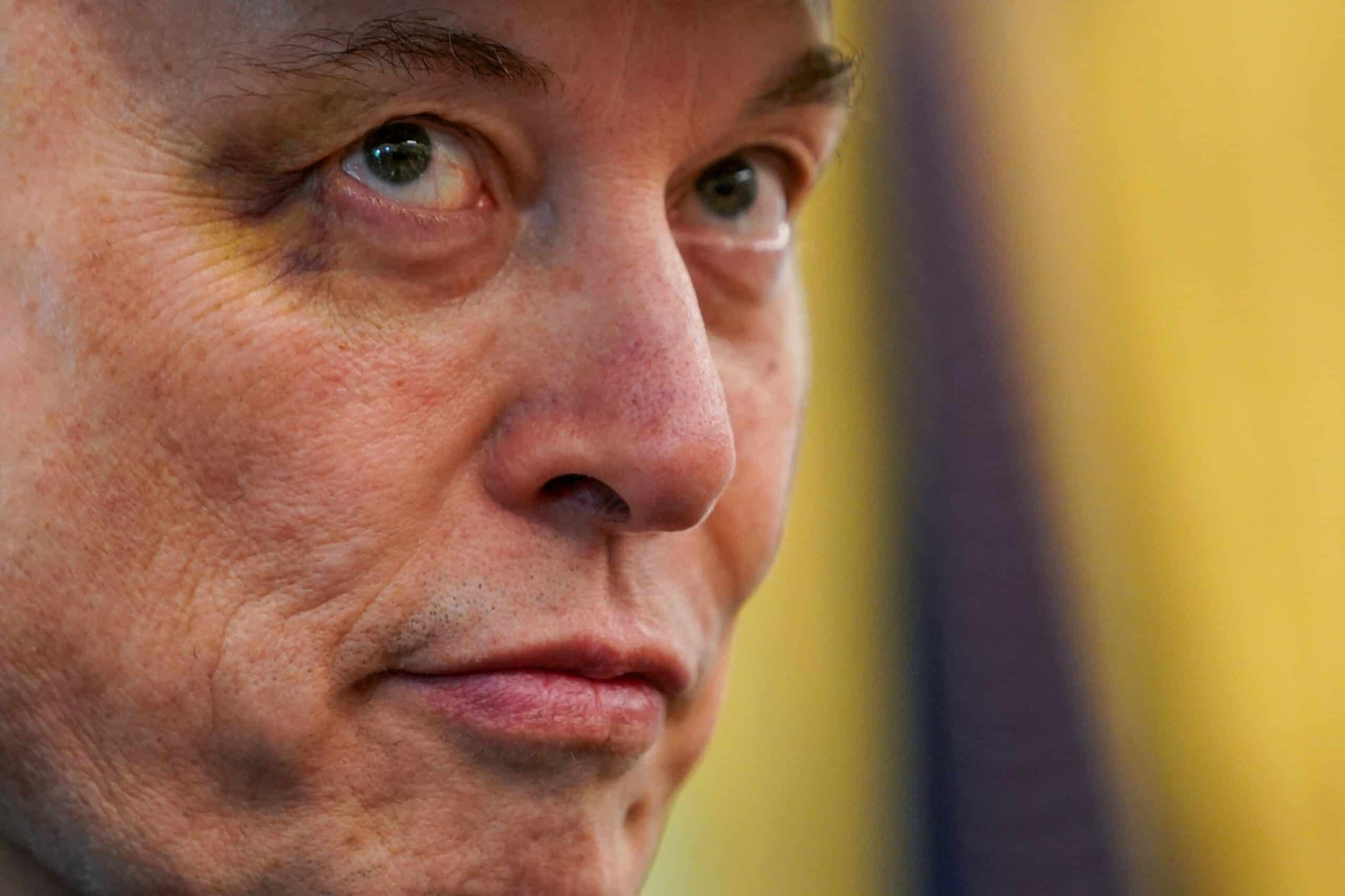 Musk Mostra Olho Roxo Após Encontro Explosivo com Trump: O Que Aconteceu?