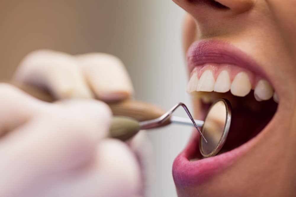 Cáries em Alerta: Desvendando os Mitos que Podem Custar Seus Dentes!