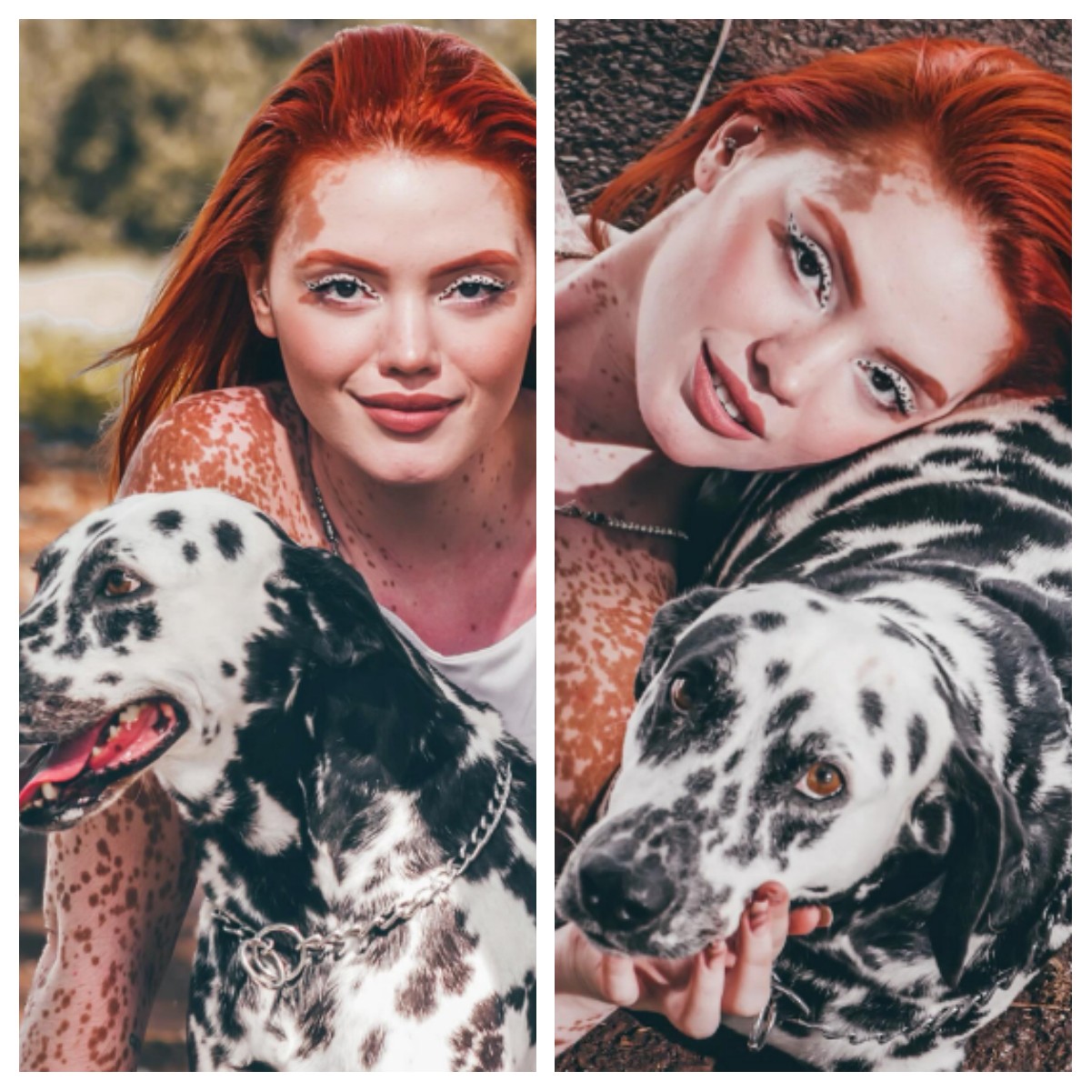 Impacto Chocante: Influencer Luta Contra o Vitiligo e Sua Identidade Racial!