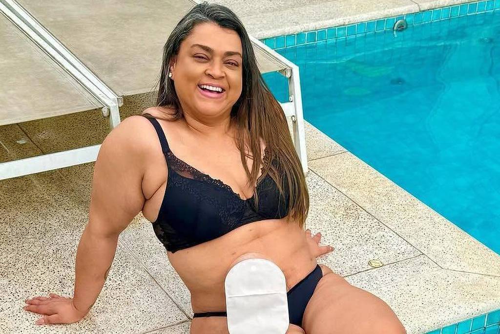 Choque: Colonoscopia Exposa Câncer Colorretal que Levou Preta Gil à Morte!