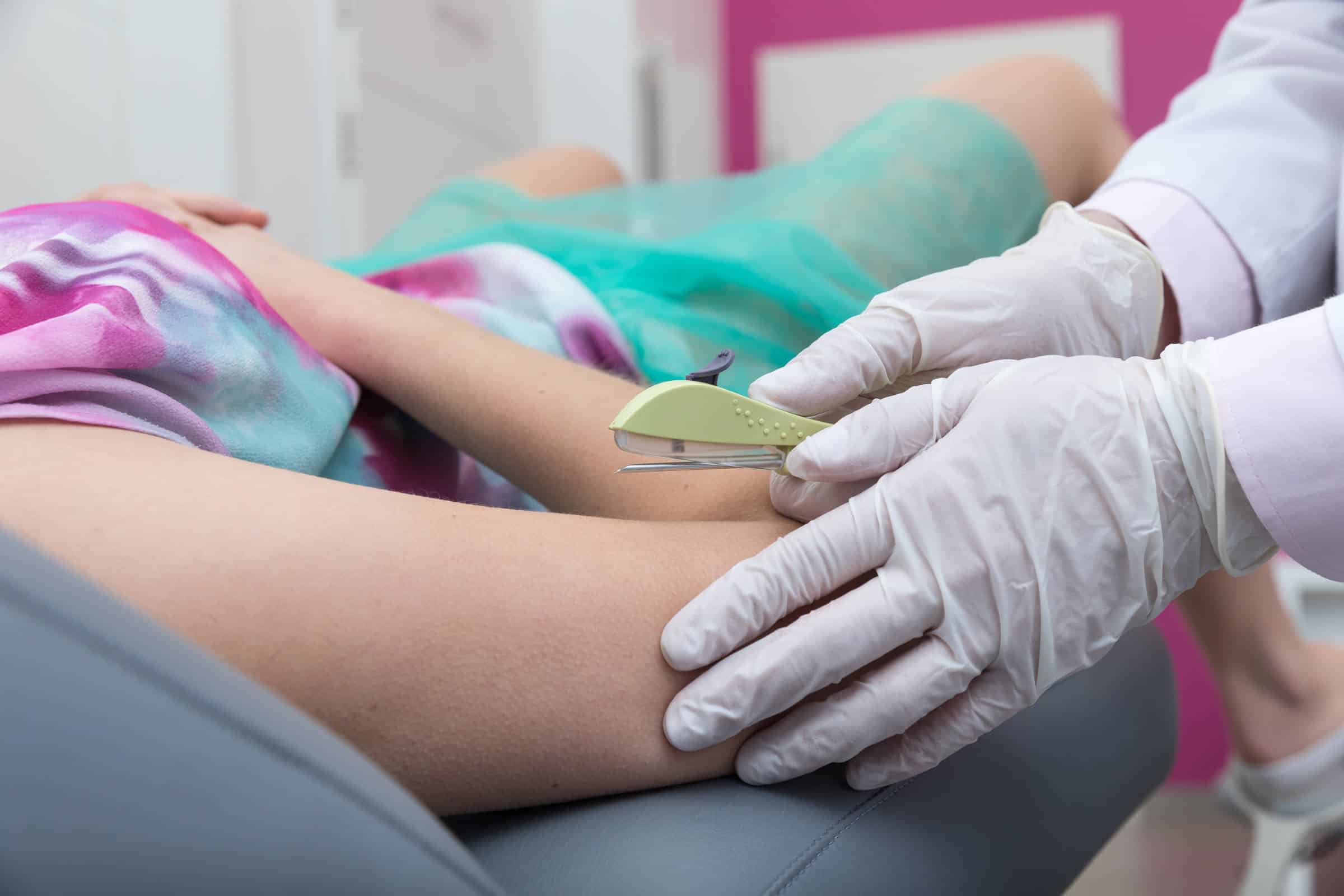 Implante Contraceptivo no SUS: O Que Você Precisa Saber AGORA!