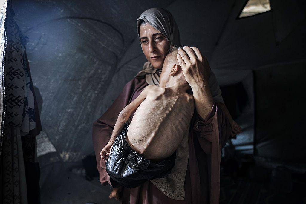 NYT em Polêmica: Retrata Crise Imoral de Criança Desnutrida em Gaza!