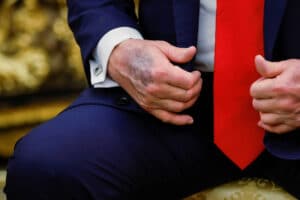 Saúde de Trump Sob Nuvens: Rumores Explodem em Meio à Opacidade!