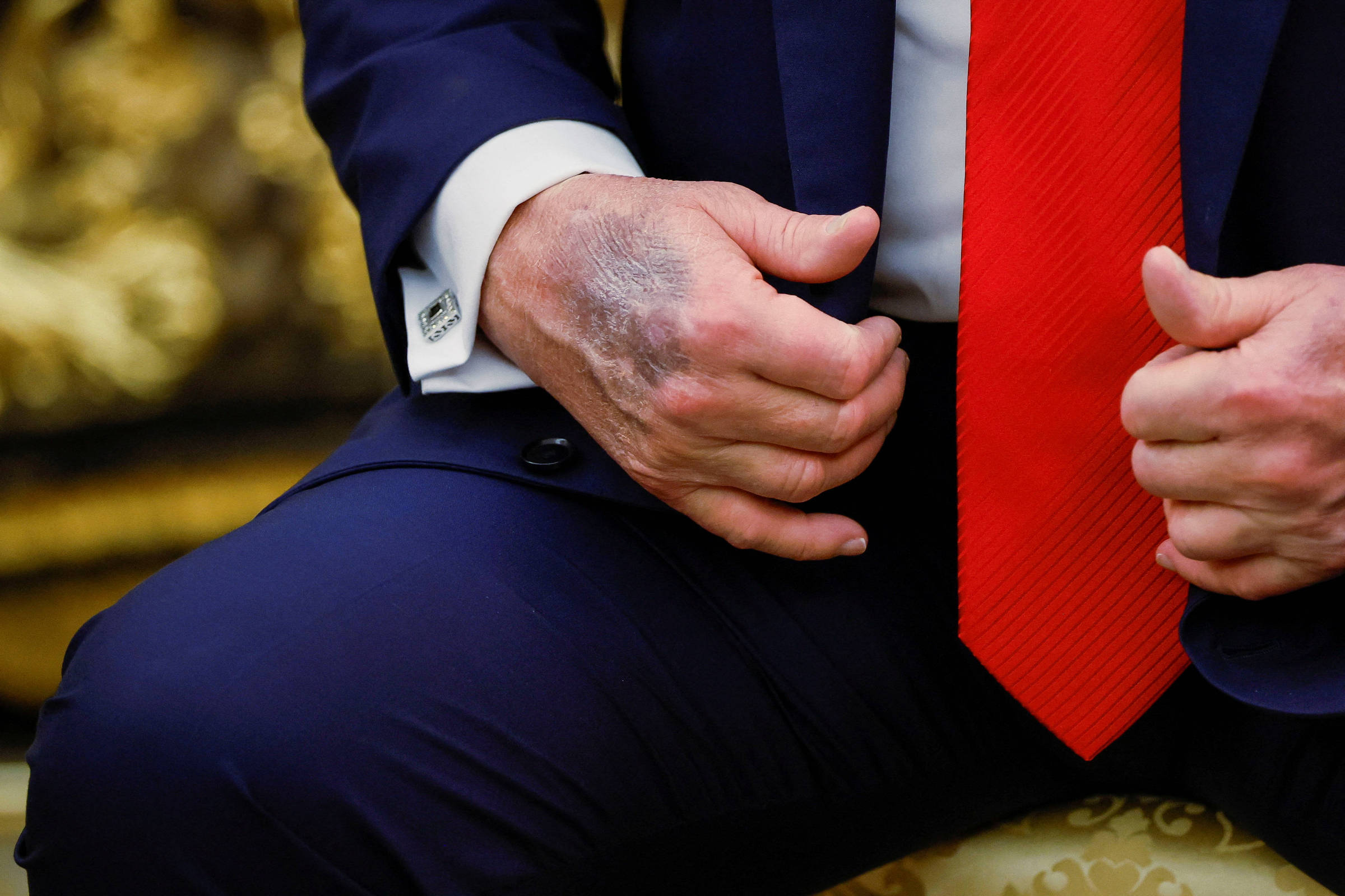 Saúde de Trump Sob Nuvens: Rumores Explodem em Meio à Opacidade!